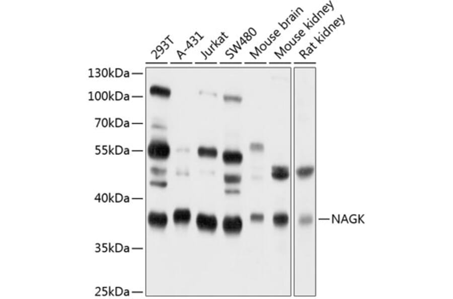 Western Blot - Anti-NAGK Antibody (A16289) - Antibodies.com