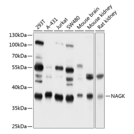 Western Blot - Anti-NAGK Antibody (A16289) - Antibodies.com