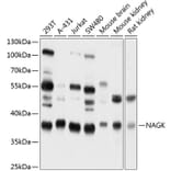 Western Blot - Anti-NAGK Antibody (A16289) - Antibodies.com