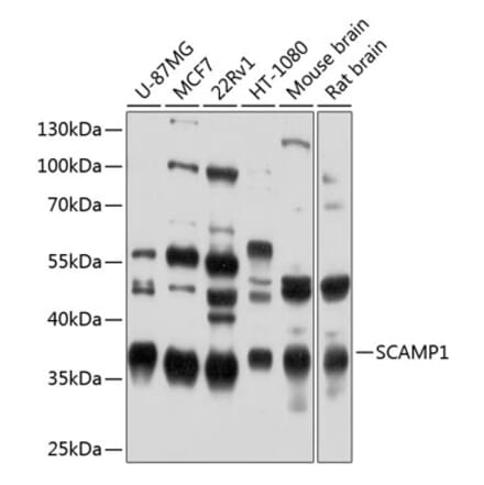 Western Blot - Anti-SCAMP1 Antibody (A16290) - Antibodies.com