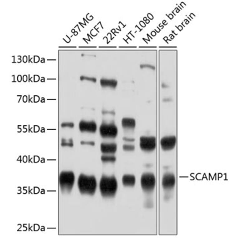 Western Blot - Anti-SCAMP1 Antibody (A16290) - Antibodies.com