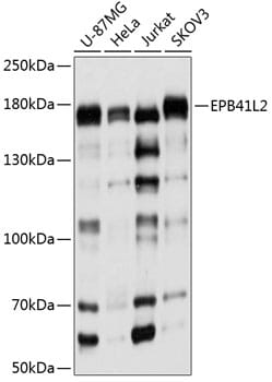 Western blot analysis of extracts of various cell lines, using Anti-EPB41L2 Antibody (A9101) at 1:1,000 dilution.
Secondary antibody: Goat Anti-Rabbit IgG (H+L) (HRP) (AS014) at 1:10,000 dilution.
Lysates / proteins: 25µg per lane.
Blocking buffer: 3% non-fat dry milk in TBST.
Detection: ECL Basic Kit (RM00020).
Exposure time: 5s.