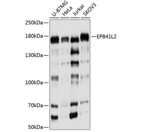 Western Blot - Anti-EPB41L2 Antibody (A16291) - Antibodies.com