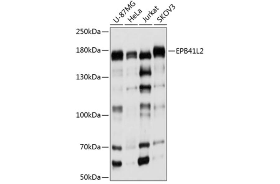 Western Blot - Anti-EPB41L2 Antibody (A16291) - Antibodies.com