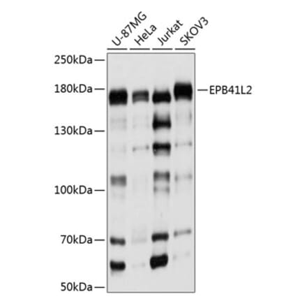 Western Blot - Anti-EPB41L2 Antibody (A16291) - Antibodies.com