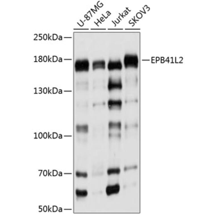 Western Blot - Anti-EPB41L2 Antibody (A16291) - Antibodies.com