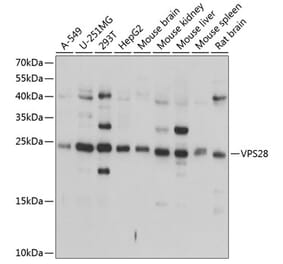 Western Blot - Anti-VPS28 Antibody (A16292) - Antibodies.com