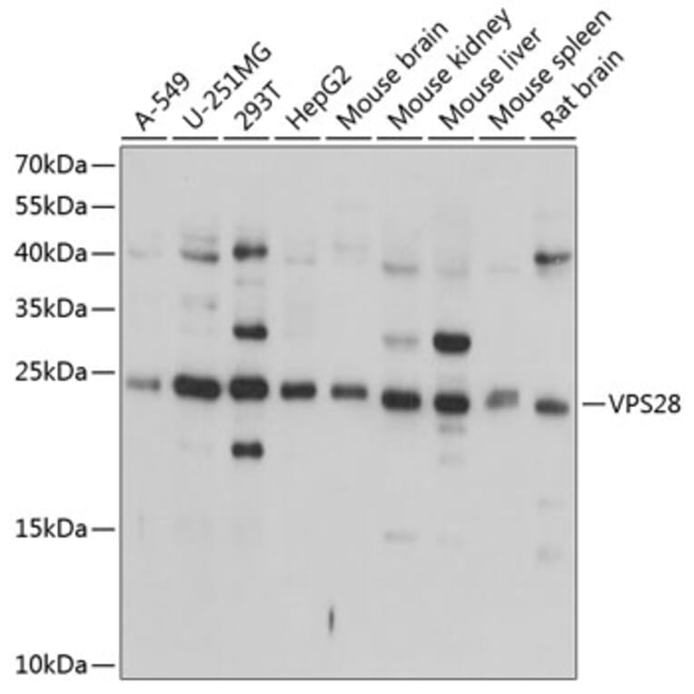 Western Blot - Anti-VPS28 Antibody (A16292) - Antibodies.com