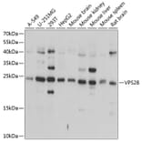 Western Blot - Anti-VPS28 Antibody (A16292) - Antibodies.com