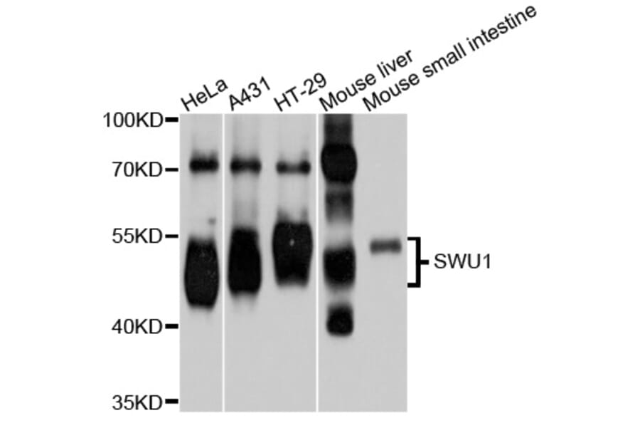 Western Blot - Anti-SMU1 Antibody (A9110) - Antibodies.com