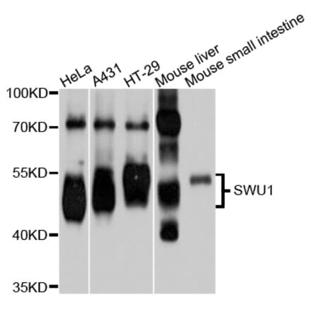 Western Blot - Anti-SMU1 Antibody (A9110) - Antibodies.com