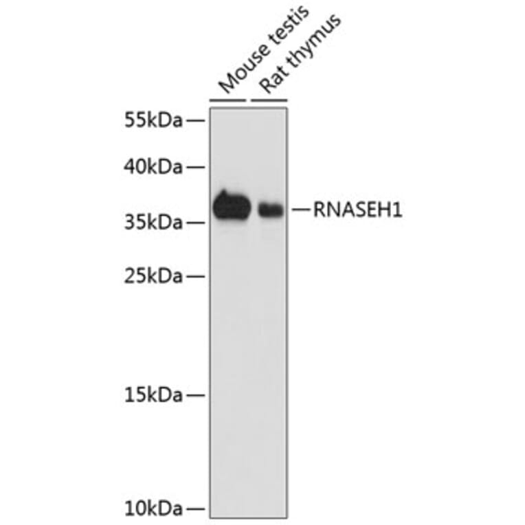 Western Blot - Anti-RNase H1/RNH1 Antibody (A16294) - Antibodies.com
