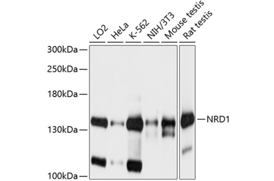 Western Blot - Anti-NRDC Antibody (A16295) - Antibodies.com