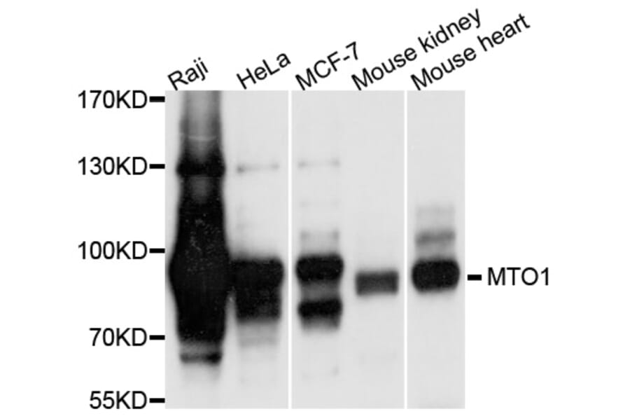 Western Blot - Anti-MTO1 Antibody (A9121) - Antibodies.com