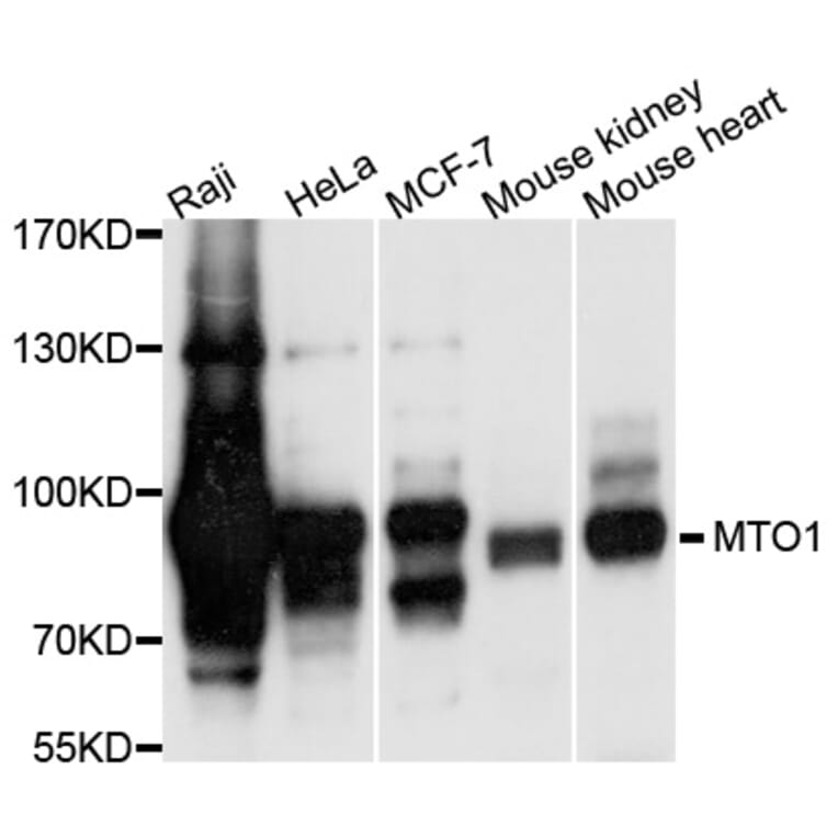 Western Blot - Anti-MTO1 Antibody (A9121) - Antibodies.com