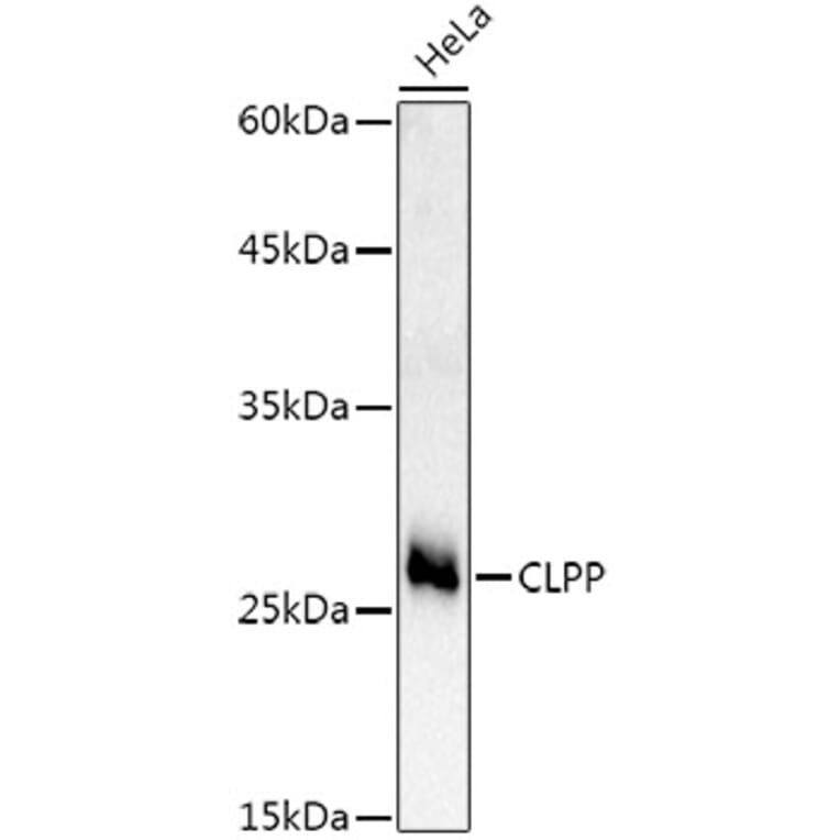 Western Blot - Anti-CLPP Antibody (A16297) - Antibodies.com