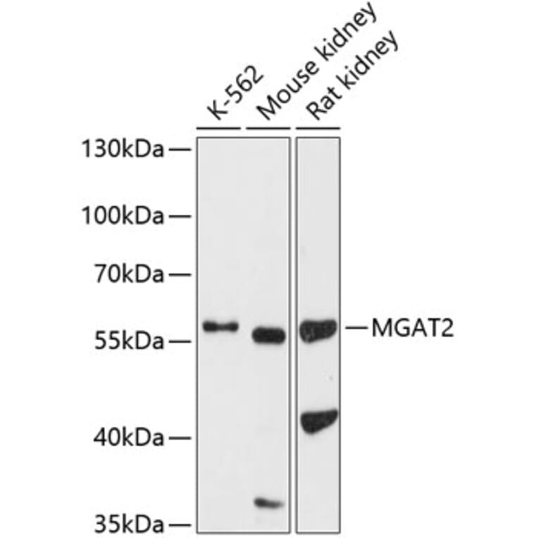 Western Blot - Anti-MGAT2 Antibody (A16298) - Antibodies.com