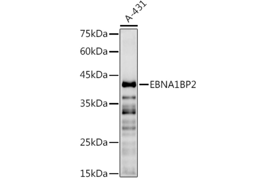 Western Blot - Anti-EBP2 Antibody (A16299) - Antibodies.com