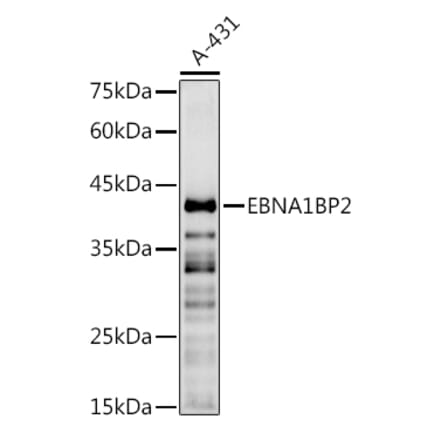 Western Blot - Anti-EBP2 Antibody (A16299) - Antibodies.com