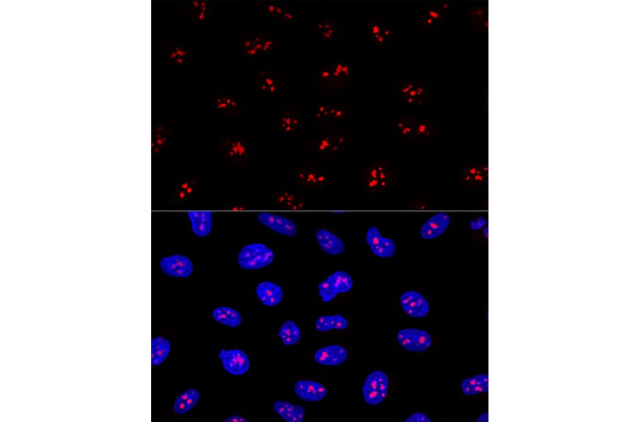 Immunofluorescence - Anti-EBP2 Antibody (A16299) - Antibodies.com