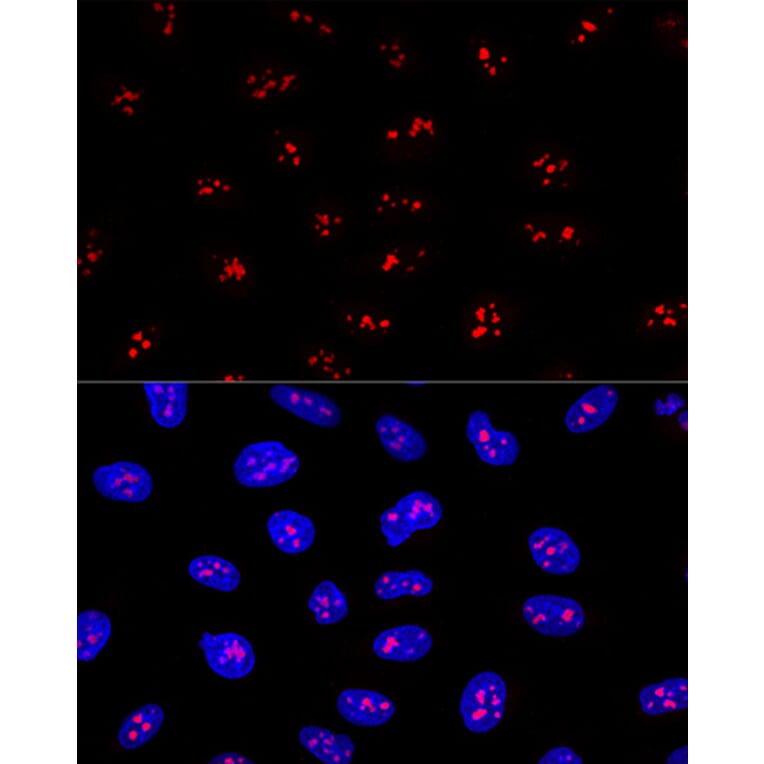 Immunofluorescence - Anti-EBP2 Antibody (A16299) - Antibodies.com