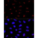 Immunofluorescence - Anti-EBP2 Antibody (A16299) - Antibodies.com