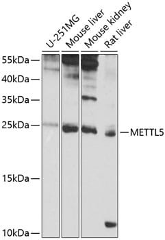 Western blot analysis of extracts of various cell lines, using Anti-METTL5 Antibody (A9217) at 1:1,000 dilution.
Secondary antibody: Goat Anti-Rabbit IgG (H+L) (HRP) (AS014) at 1:10,000 dilution.
Lysates / proteins: 25µg per lane.
Blocking buffer: 3% non-fat dry milk in TBST.
Detection: ECL Basic Kit (RM00020).
Exposure time: 8s.