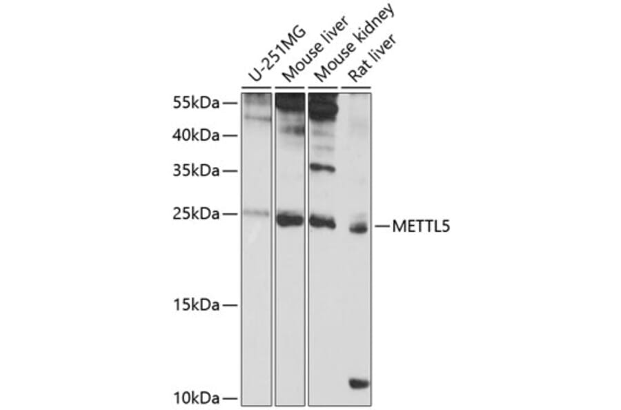 Western Blot - Anti-METTL5 Antibody (A16302) - Antibodies.com