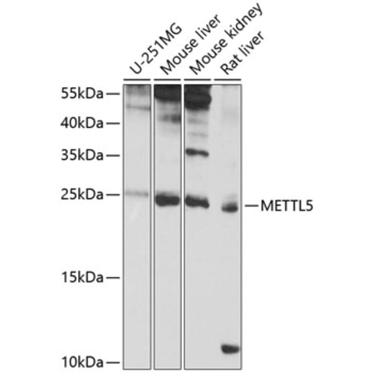 Western Blot - Anti-METTL5 Antibody (A16302) - Antibodies.com