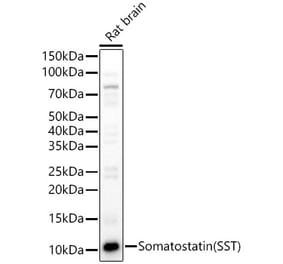 Western Blot - Anti-Somatostatin Antibody (A16303) - Antibodies.com