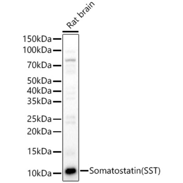 Western Blot - Anti-Somatostatin Antibody (A16303) - Antibodies.com