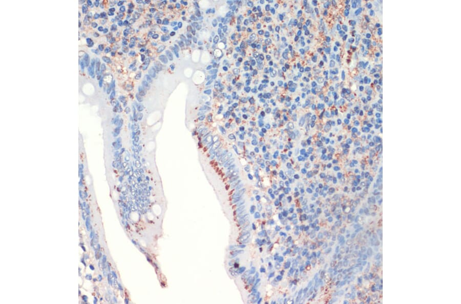 Immunohistochemistry - Anti-Somatostatin Antibody (A16303) - Antibodies.com