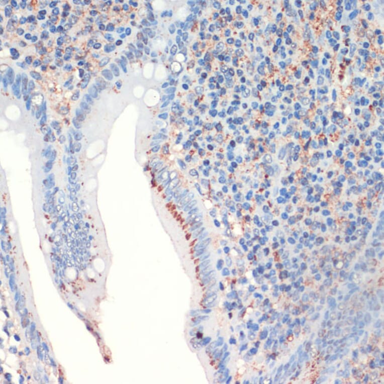 Immunohistochemistry - Anti-Somatostatin Antibody (A16303) - Antibodies.com