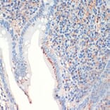 Immunohistochemistry - Anti-Somatostatin Antibody (A16303) - Antibodies.com