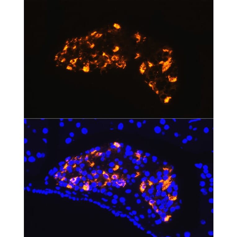 Immunofluorescence - Anti-Somatostatin Antibody (A16303) - Antibodies.com