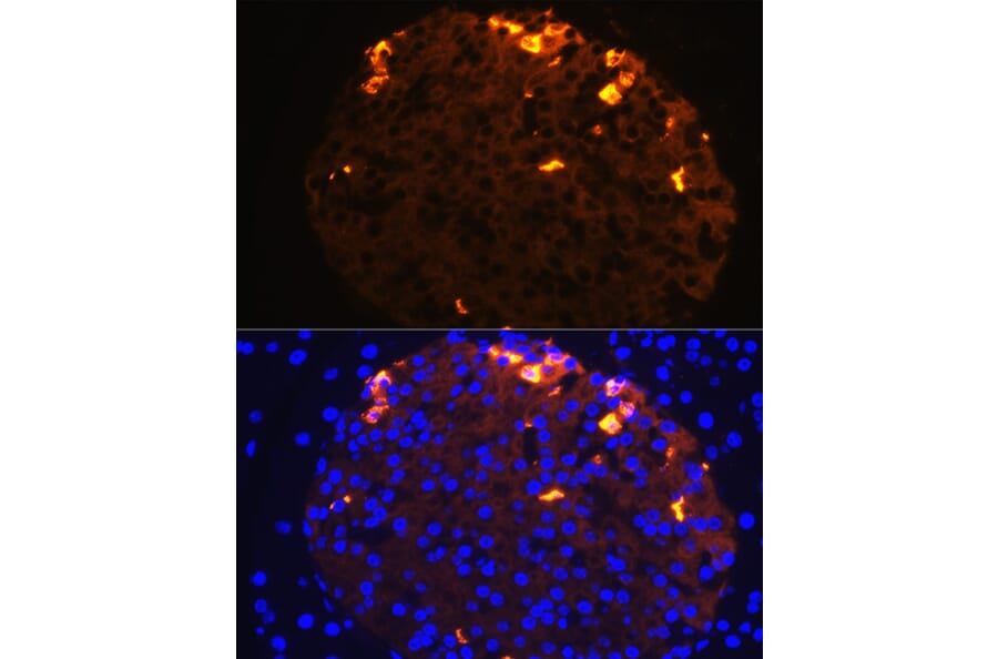 Immunofluorescence - Anti-Somatostatin Antibody (A16303) - Antibodies.com
