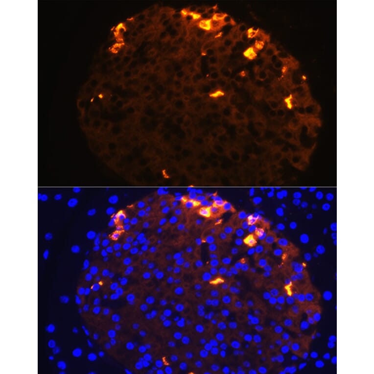 Immunofluorescence - Anti-Somatostatin Antibody (A16303) - Antibodies.com