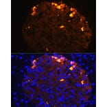 Immunofluorescence - Anti-Somatostatin Antibody (A16303) - Antibodies.com