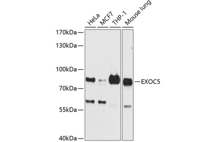 Western Blot - Anti-SEC10 Antibody (A16304) - Antibodies.com
