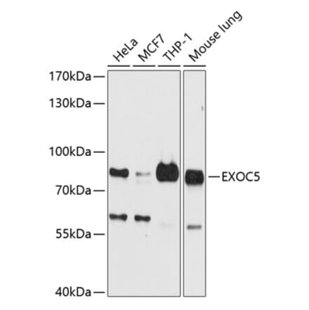 Western Blot - Anti-SEC10 Antibody (A16304) - Antibodies.com