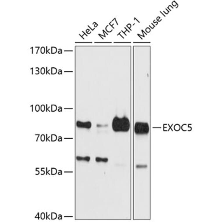 Western Blot - Anti-SEC10 Antibody (A16304) - Antibodies.com