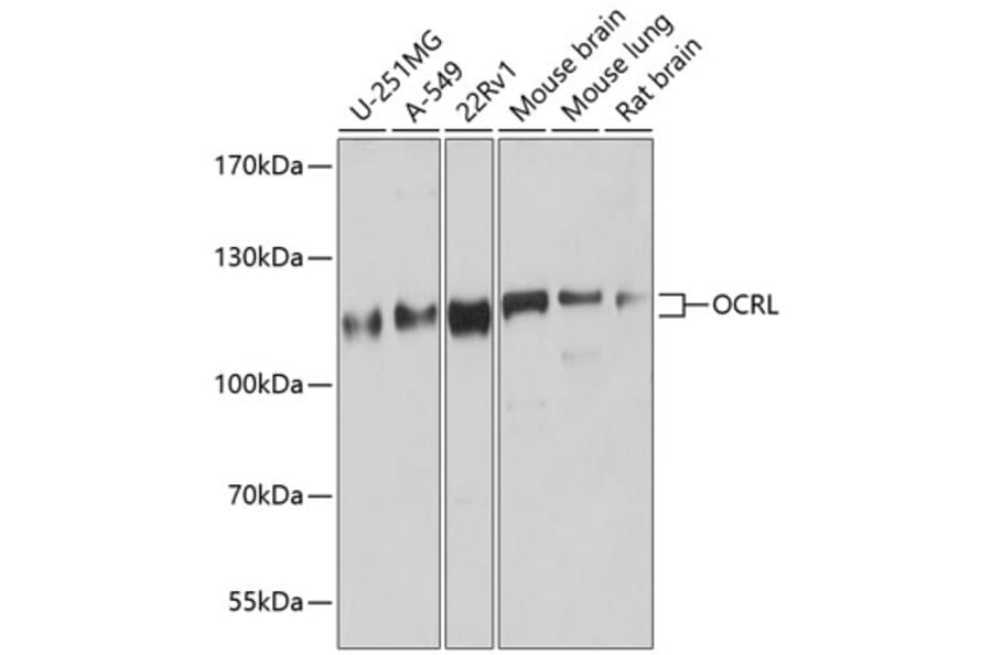 Western Blot - Anti-OCRL Antibody (A9290) - Antibodies.com
