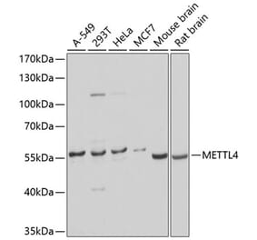 Western Blot - Anti-METTL4 Antibody (A16307) - Antibodies.com