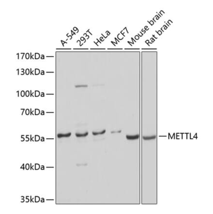 Western Blot - Anti-METTL4 Antibody (A16307) - Antibodies.com