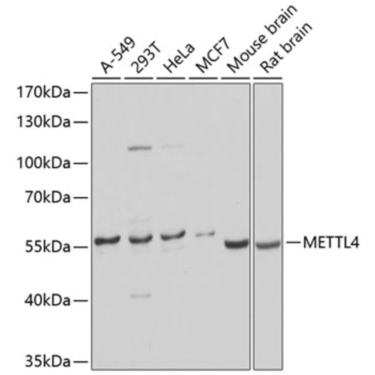 Western Blot - Anti-METTL4 Antibody (A16307) - Antibodies.com