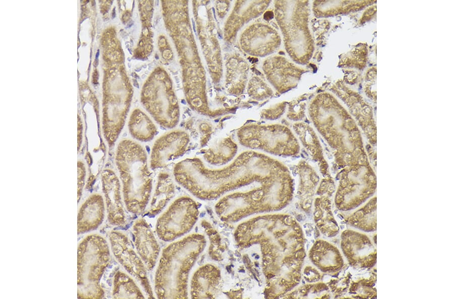 Immunohistochemistry - Anti-METTL4 Antibody (A16307) - Antibodies.com