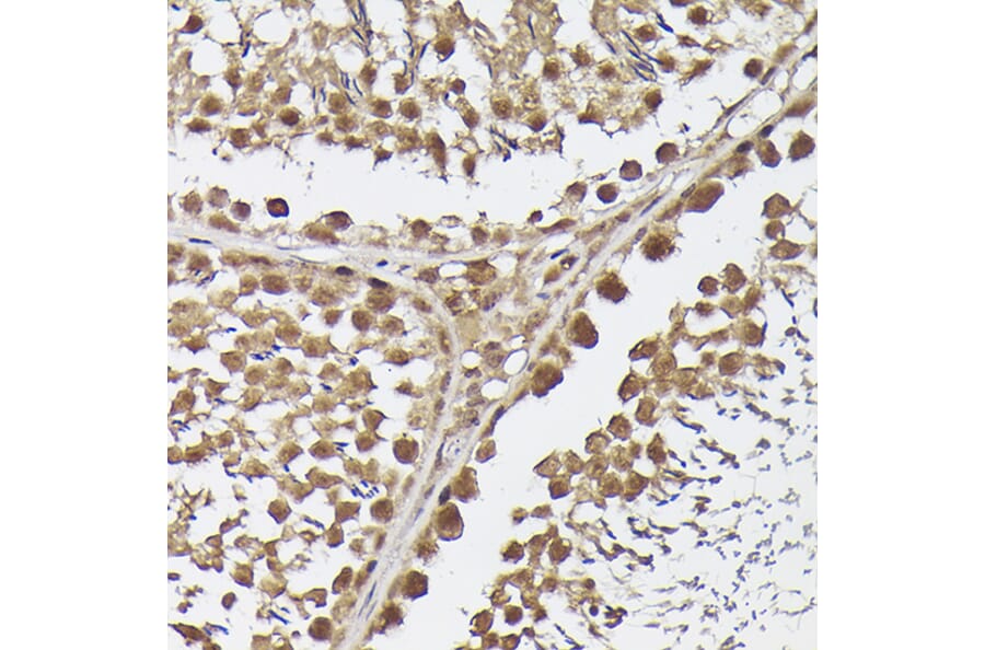 Immunohistochemistry - Anti-METTL4 Antibody (A16307) - Antibodies.com
