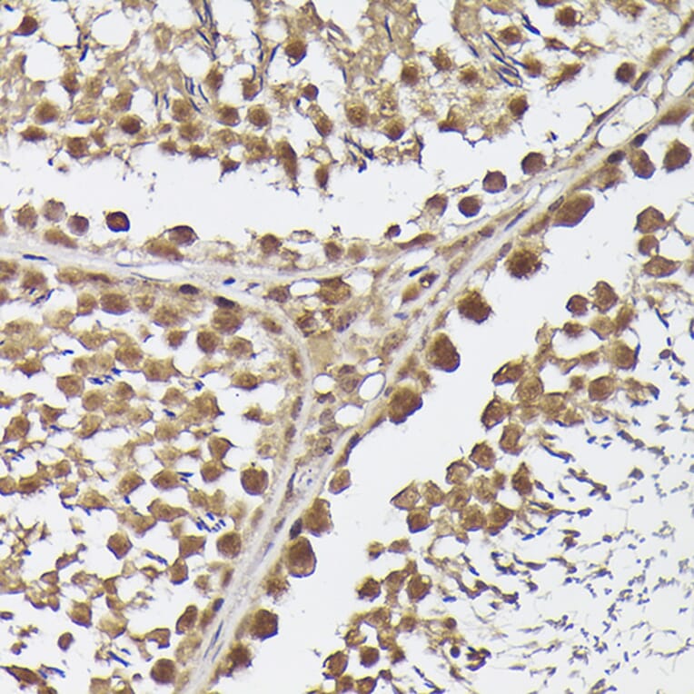 Immunohistochemistry - Anti-METTL4 Antibody (A16307) - Antibodies.com
