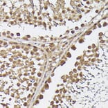 Immunohistochemistry - Anti-METTL4 Antibody (A16307) - Antibodies.com