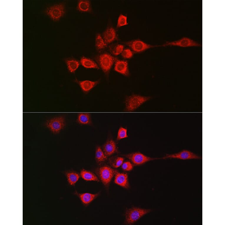 Immunofluorescence - Anti-METTL4 Antibody (A16307) - Antibodies.com